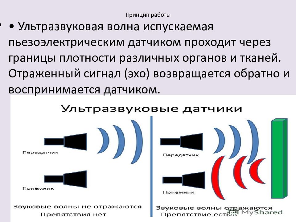 Ультразвук волны