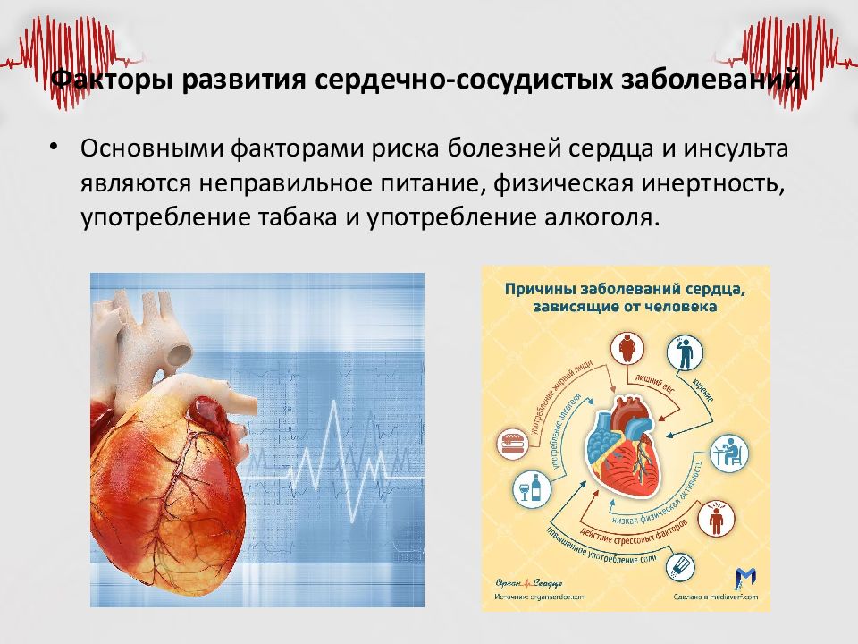 Сердечные заболевания сообщение. Сердечно-сосудистые заболевания. Болезни сердечно-сосудистой системы. Заболеваний сердца и сердечно-сосудистой системы. Нарушение сердечно сосудистой системы.