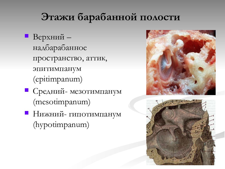 Стенки барабанной полости сообщения