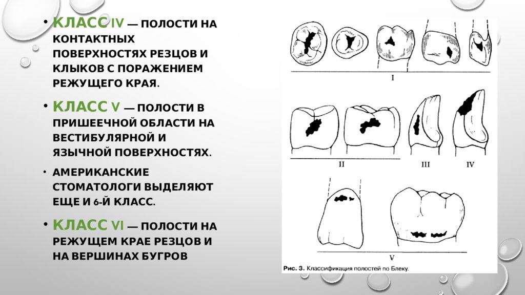 Классификация полостей