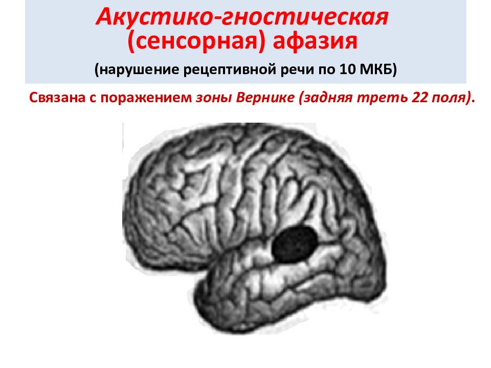 Онмк моторная афазия карта вызова