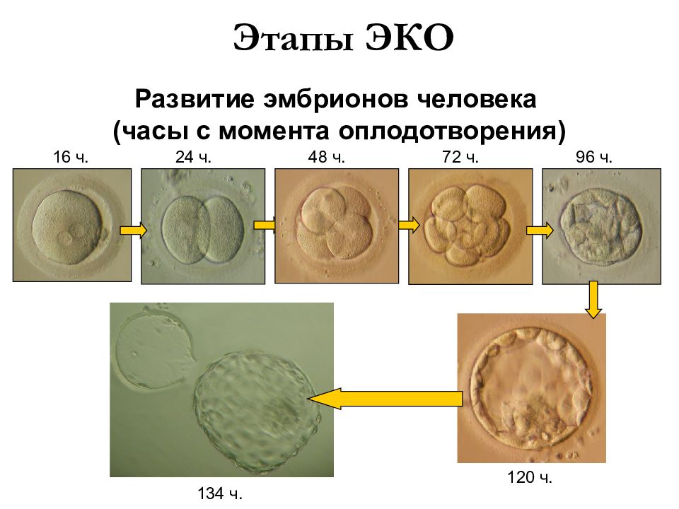 Подсадка эмбрионов