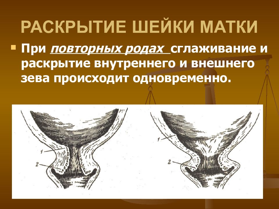Раскрытие шейки матки картинка