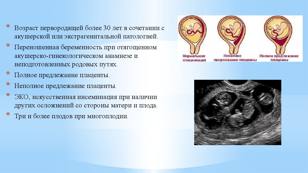 Предлежание на 12 неделе. Предлежание плаценты головное. Предлежание плаценты при беременности. Осложнения предлежания плаценты для матери. Полное предлежание плаценты УЗИ.