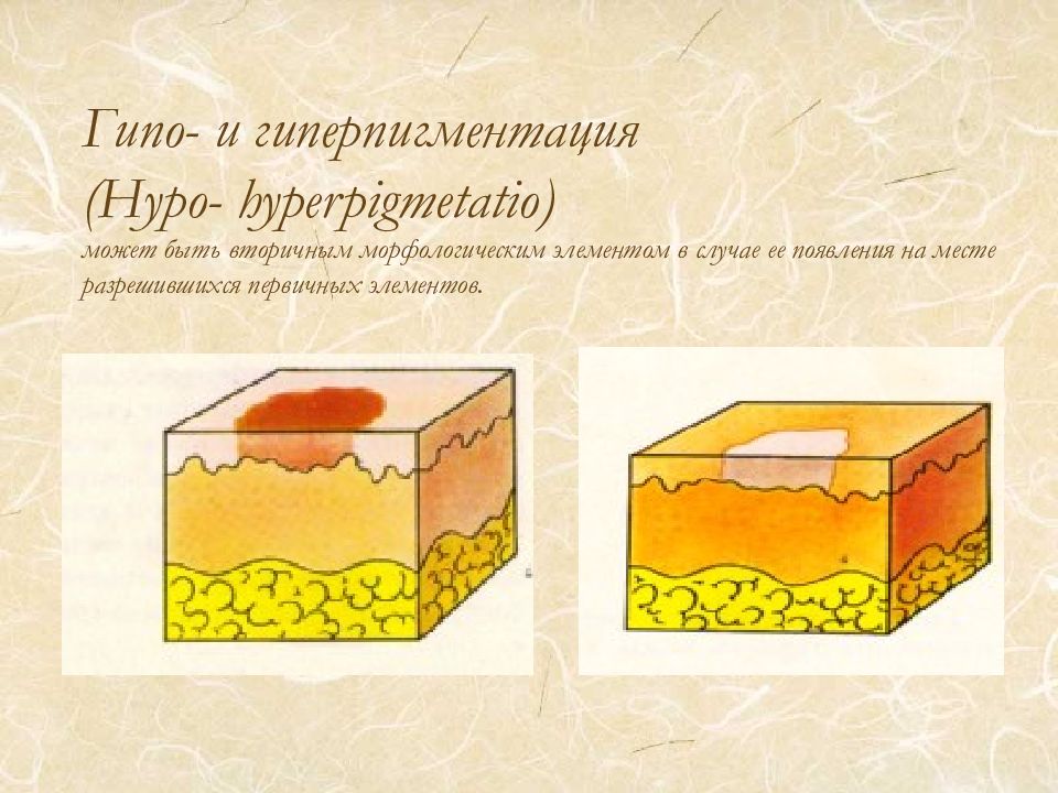 Морфологические элементы кожи презентация