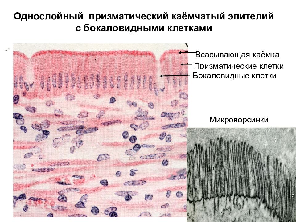 Клетки эпителия кишечника рисунок