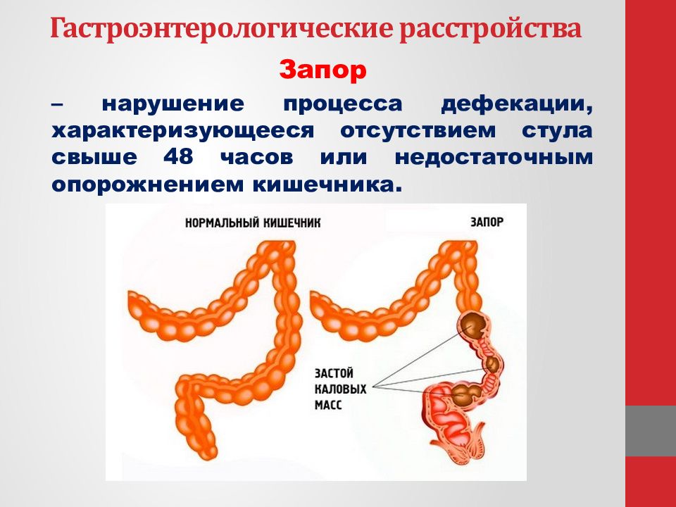 Причины боли после опорожнения кишечника