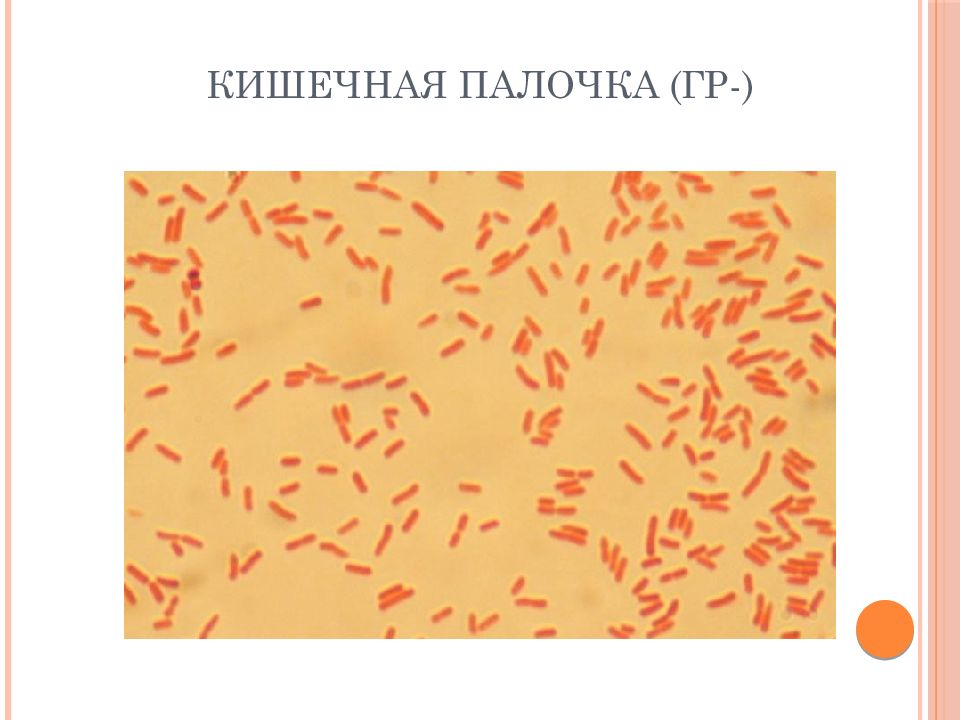 Гр палочки. Кишечная палочка микробиология. Кишечная палочка грамм. Кишечная палочка рисунок микробиология. E coli микробиология.