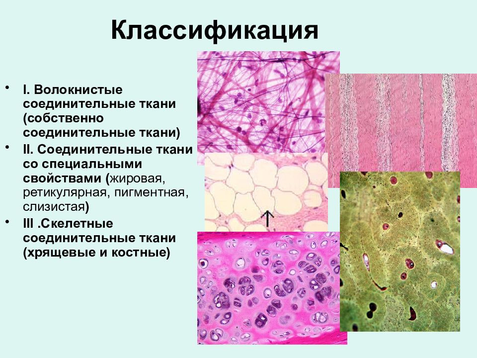 Какая ткань изображена на картинке хрящевые ткани