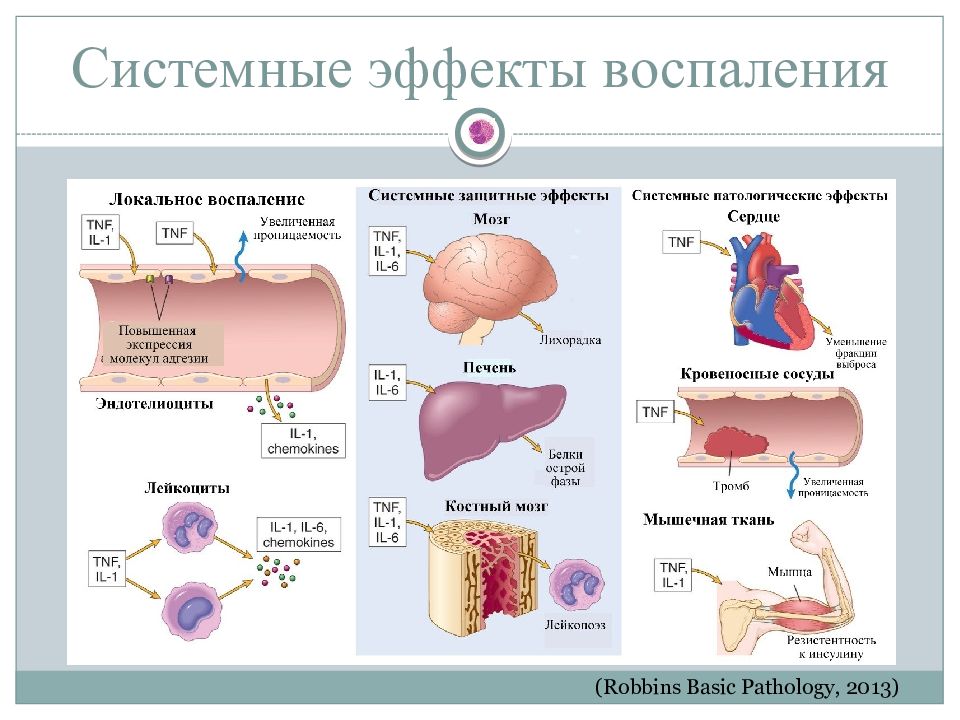 Воспаление ответ