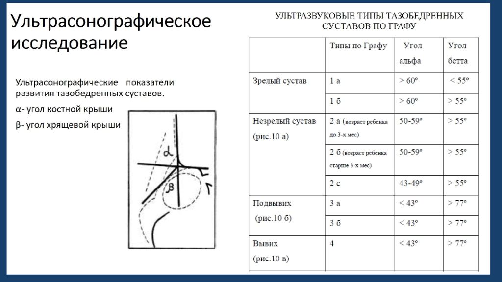 Нормы углов тазобедренных суставов. УЗИ Т/Б суставов у новорожденных норма. Угол бета тазобедренного сустава норма у грудничков. Углы тазобедренных суставов норма таблица. Дисплазия тазобедренных суставов углы норма.