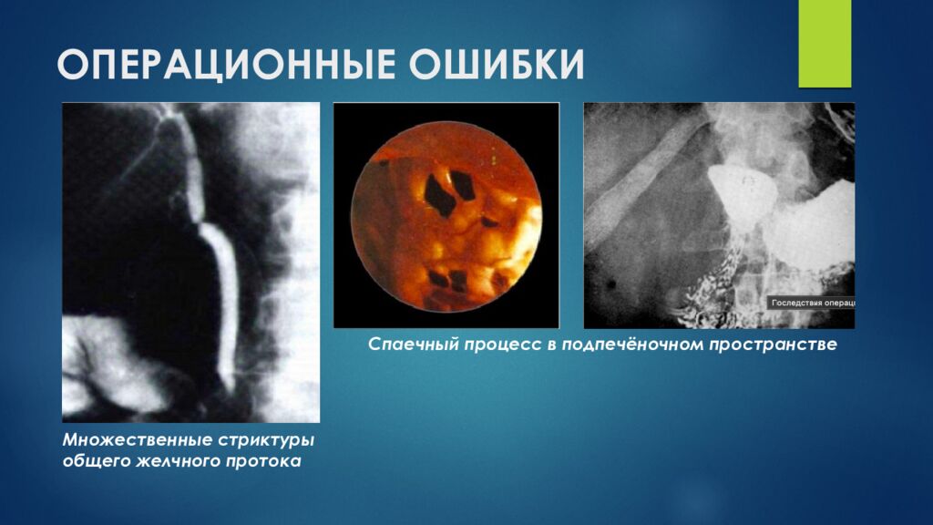 ОПЕРАЦИОННЫЕ ОШИБКИ