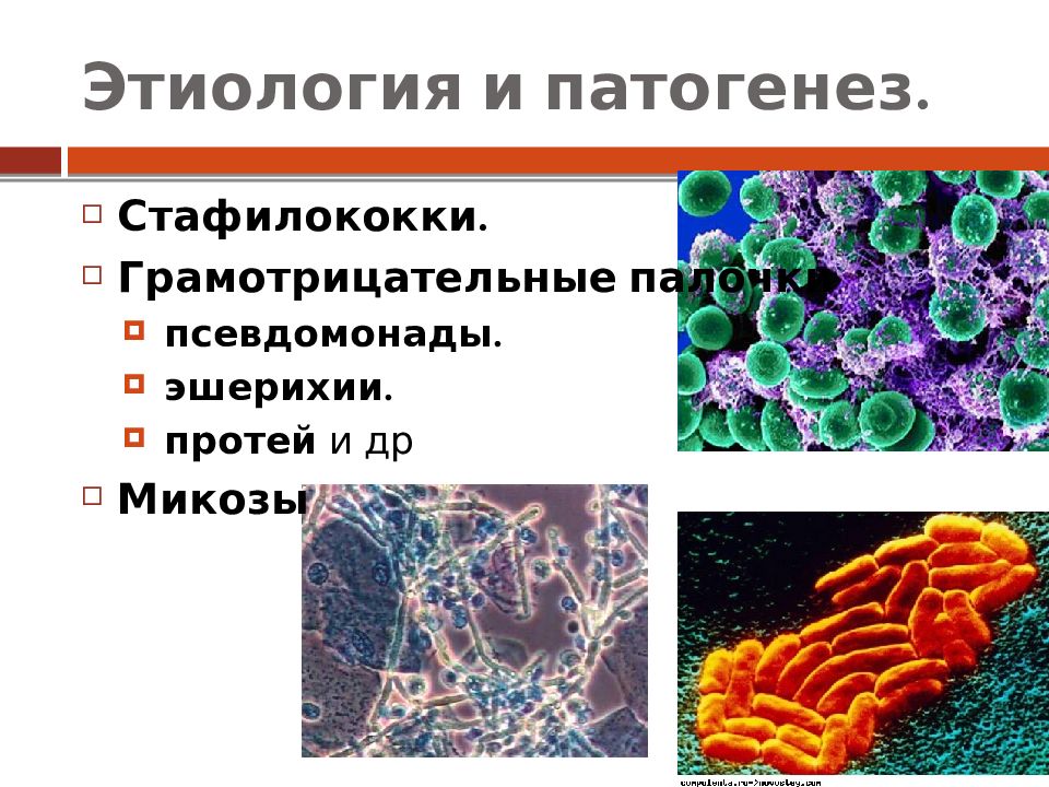 Этиология картинки для презентации