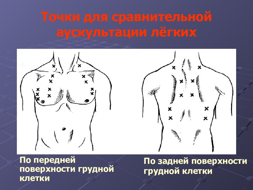 Точки аускультации легких схема