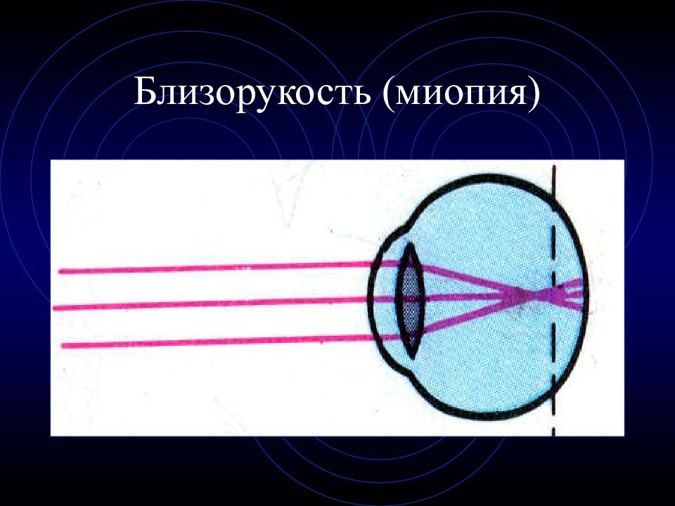 Анализатор зрительный слуховой вестибулярный