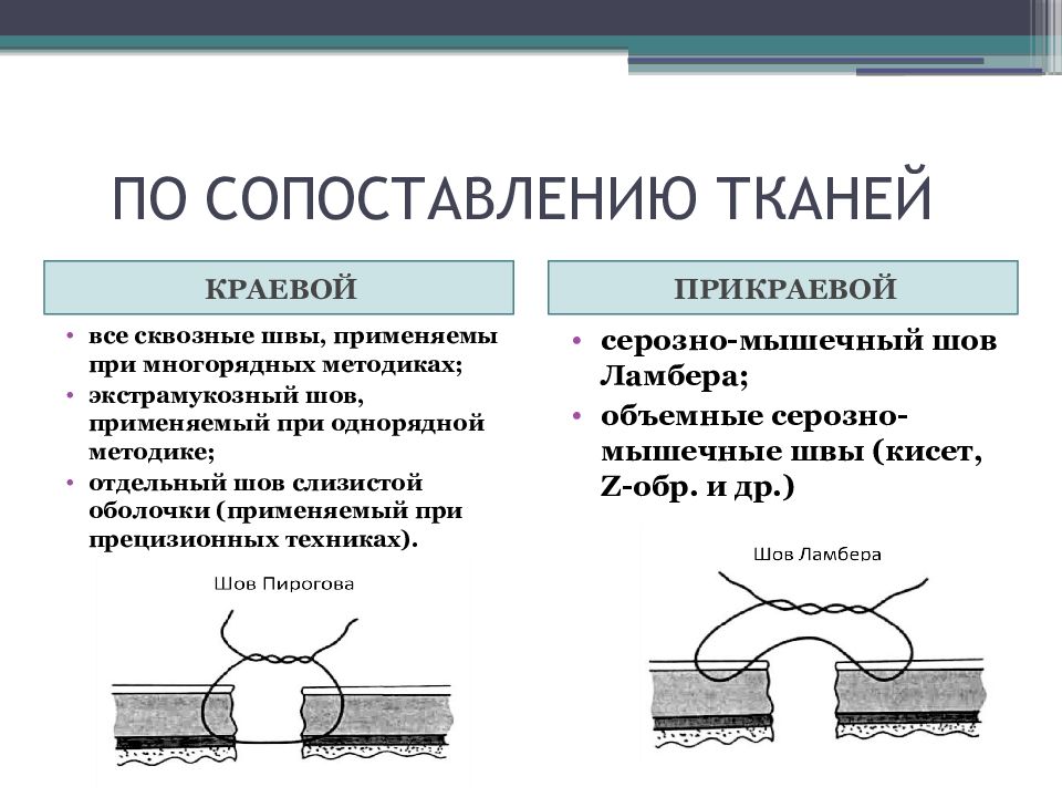 Кишечный шов презентация