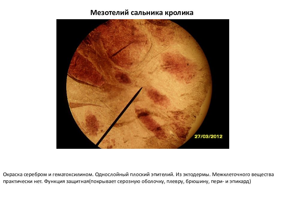 Препарат мезотелий брюшины. Мезотелий сальника кролика гистология. Поперечно-полосатая скелетная мышечная ткань языка кролика. Скелетная мышечная ткань гистология препарат. Гистология кролика.