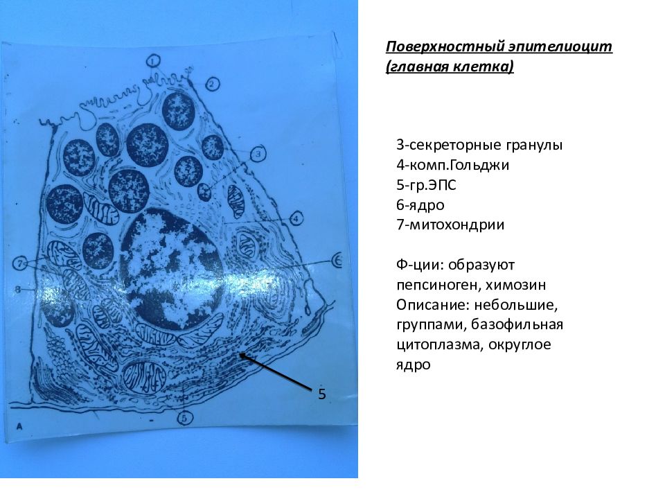 Клетка 2 описание. Поверхностный эпителиоцит. Секреторные гранулы Гольджи. Эпителиоциты цитоплазма. Секреторные гранулы в ядре.