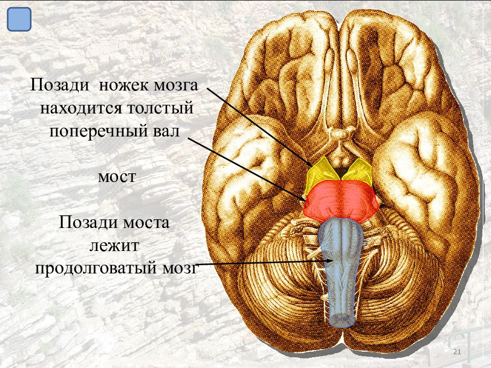 Ноги мозг голова. Ножки мозга. Строение ножек мозга. Ножки среднего мозга. Медиальная поверхность ножки мозга.