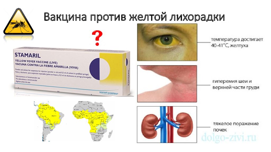 Лечение желтых. Вакцина против желтой лихорадки. Вакцина для профилактики желтой лихорадки. Желтая лихорадка прививка. Желтая лихорадка вакцина название.