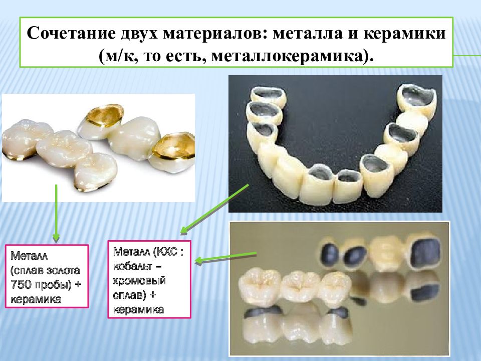 Стоматологическая керамика презентация