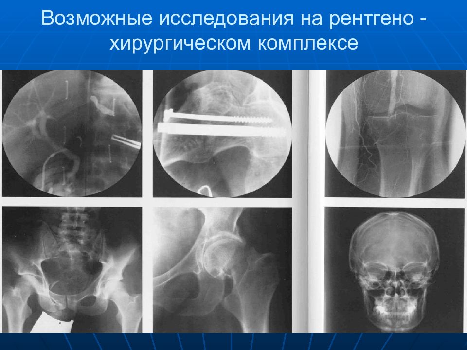 Лучевая диагностика презентация