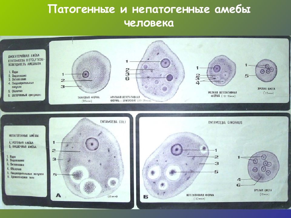 Амеба кишечная рисунок