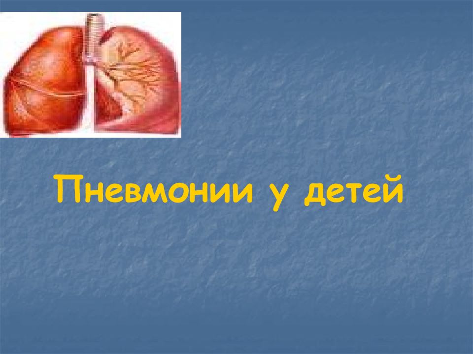 Пневмонии у детей