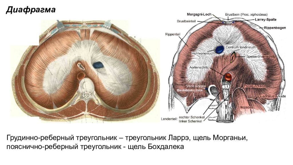 Грыжа бохдалека. Треугольник Морганьи и Ларрея. Щель Ларрея диафрагма. Пояснично реберный треугольник диафрагмы.