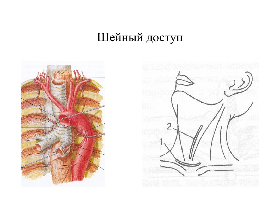Операции на шее топографическая анатомия презентация