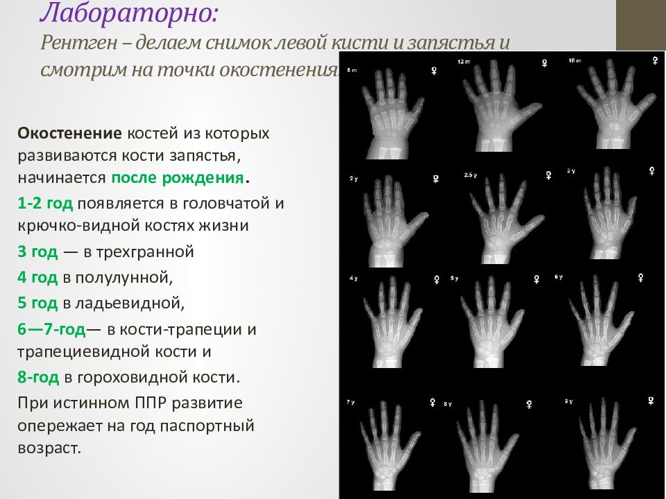 Презентация преждевременное половое развитие