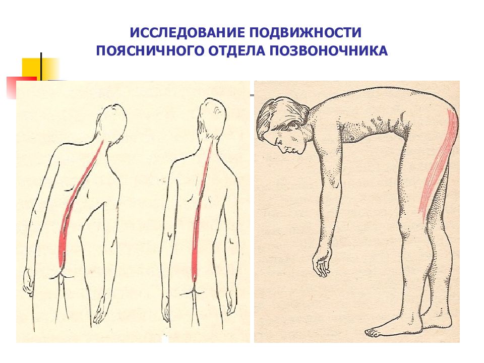 Боль в спине карта вызова