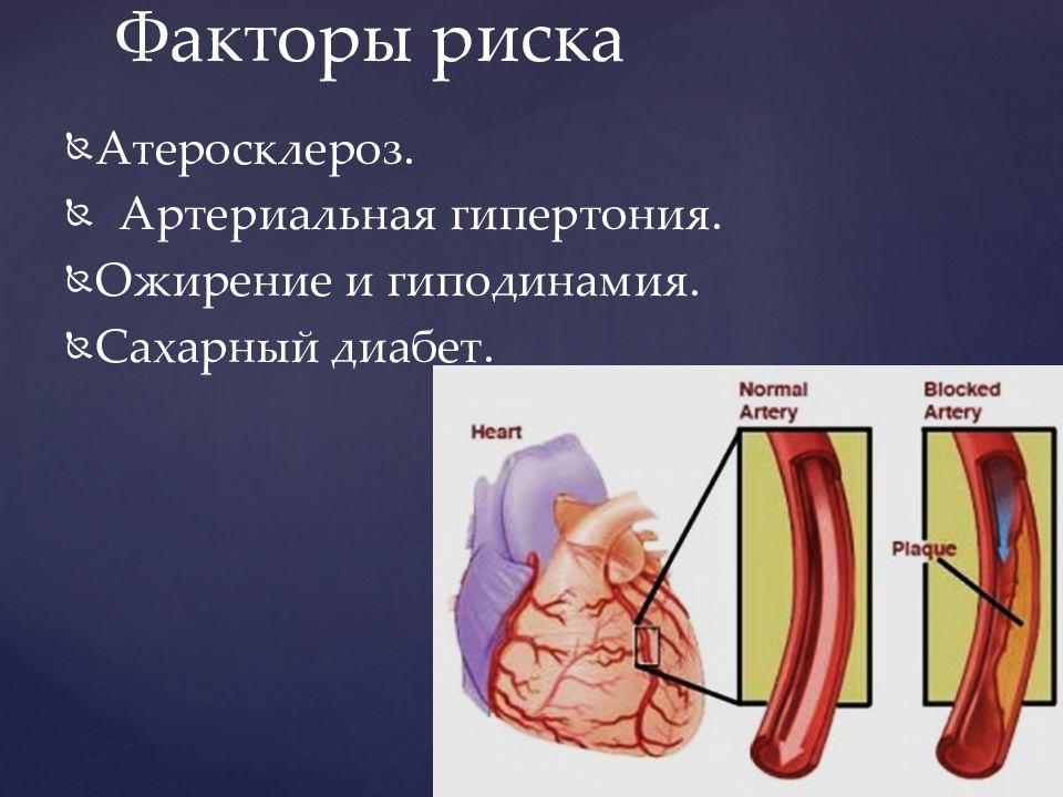 Презентация ишемия инфаркт миокарда