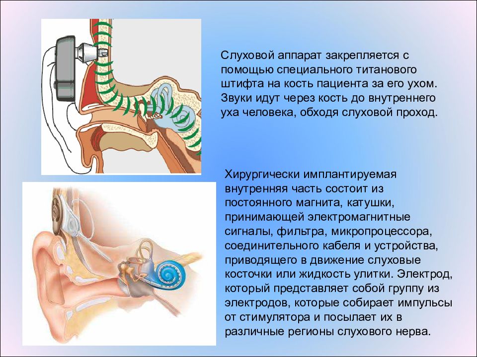 Через слухи. Слуховой аппарат через кость. Сигналы в слуховых аппаратах. Слуховой аппарат через кости черепа. Аппарат звука через кости.