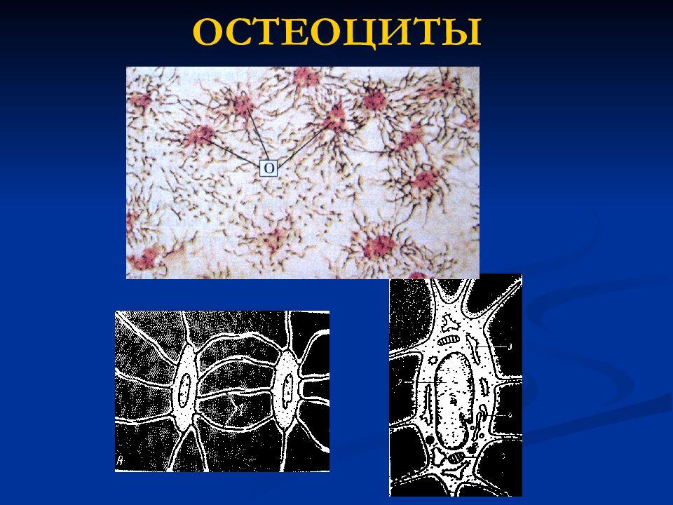 Остеоциты функции. Скелетная соединительная ткань. Остеоциты под микроскопом. Соединительная ткань презентация. Остеоцит морфология.