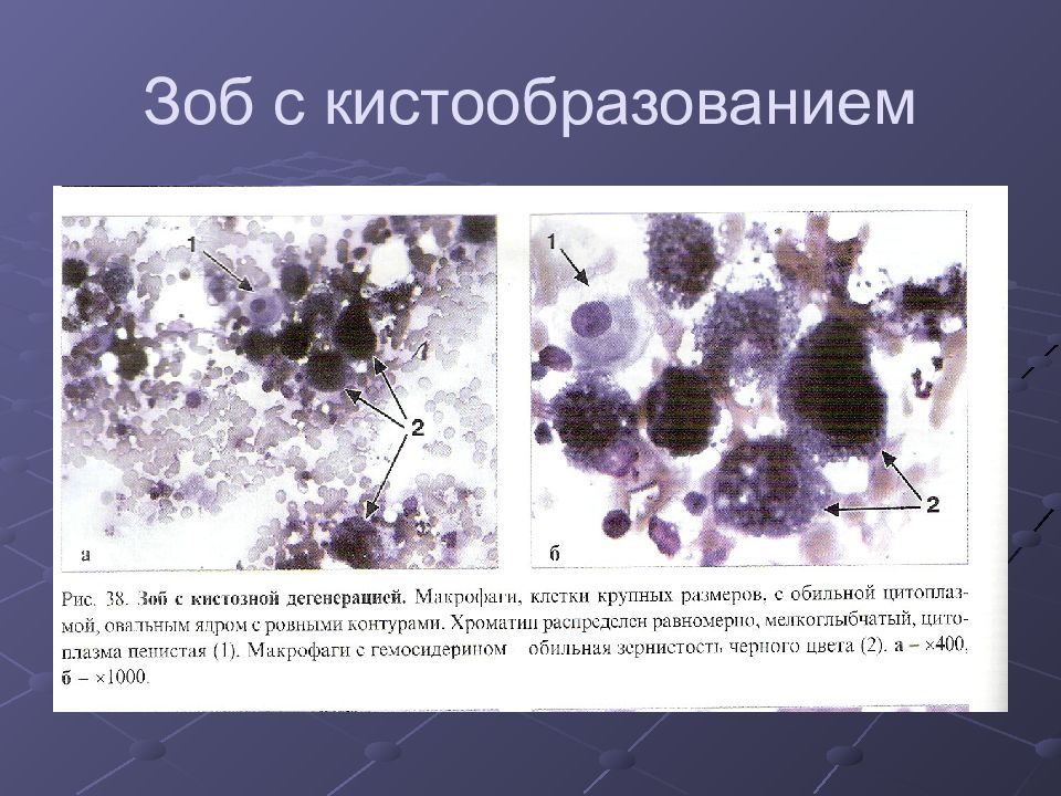 Диагностика щитовидной железы презентация