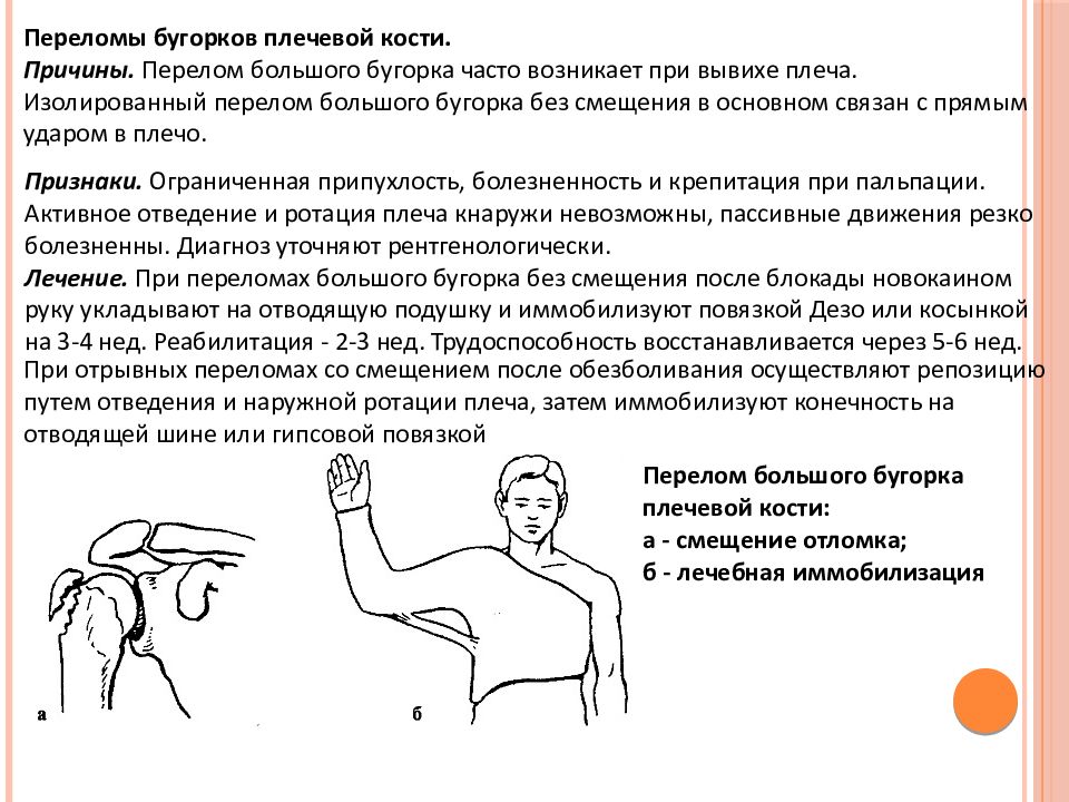 Повреждения плечевого пояса презентация