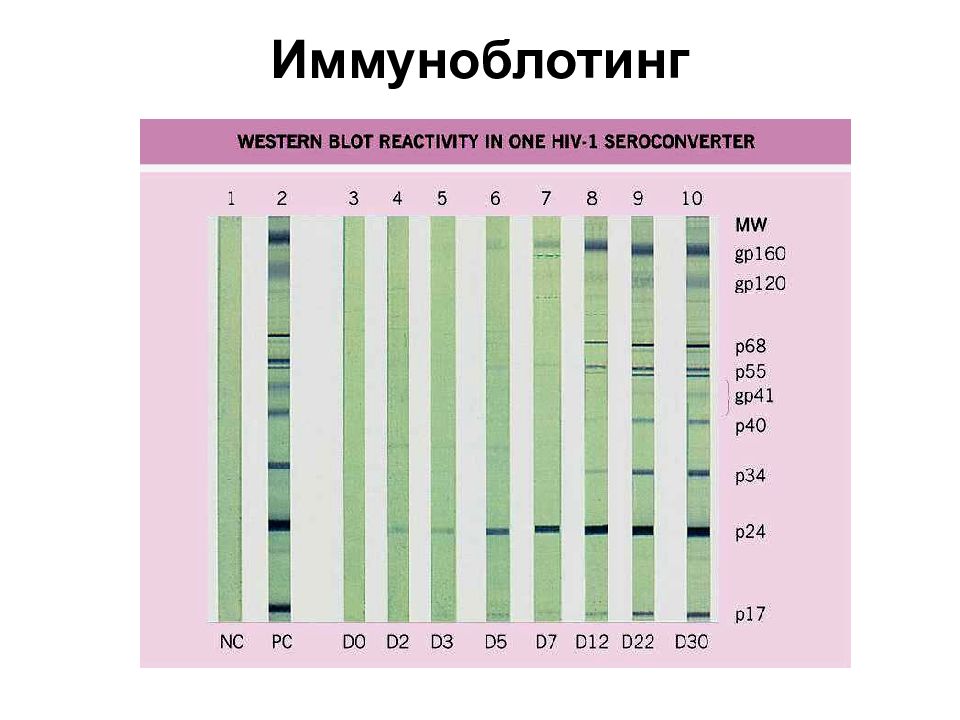 Иммунный блотинг. -Иммуноблот (иммунный блоттинг).. Иммуноблот ВИЧ. Иммуноблоттинг для диагностики ВИЧ инфекции. Иммуноблоттинг компоненты реакции.