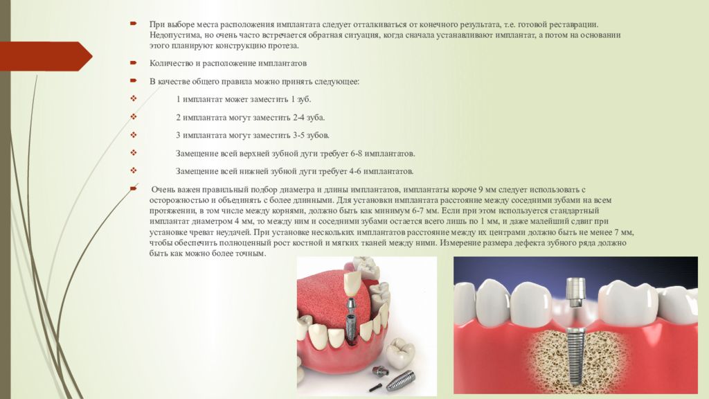 Противопоказания для имплантов. Строение и классификация имплантатов. Классификация имплантов по материалу. Выбор диаметра имплантата. Классы имплантов зубов классификация.