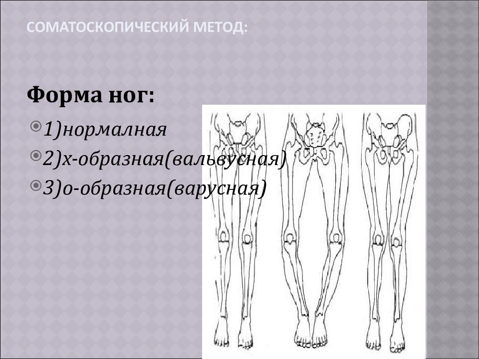 Формы ног. Форма ног. Оценка формы ног. Ноги х образной формы.