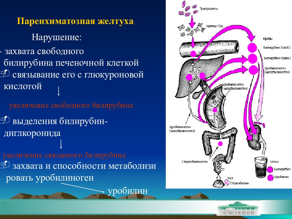 Желтуха печени. Паренхиматозная желтуха патогенез. Паренхиматозная желтуха механизм развития. Механизм образования подпеченочной желтухи. Печеночная желтуха патогенез.