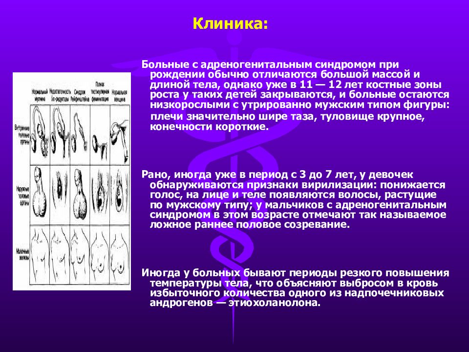 Адреногенитальным синдромом фото