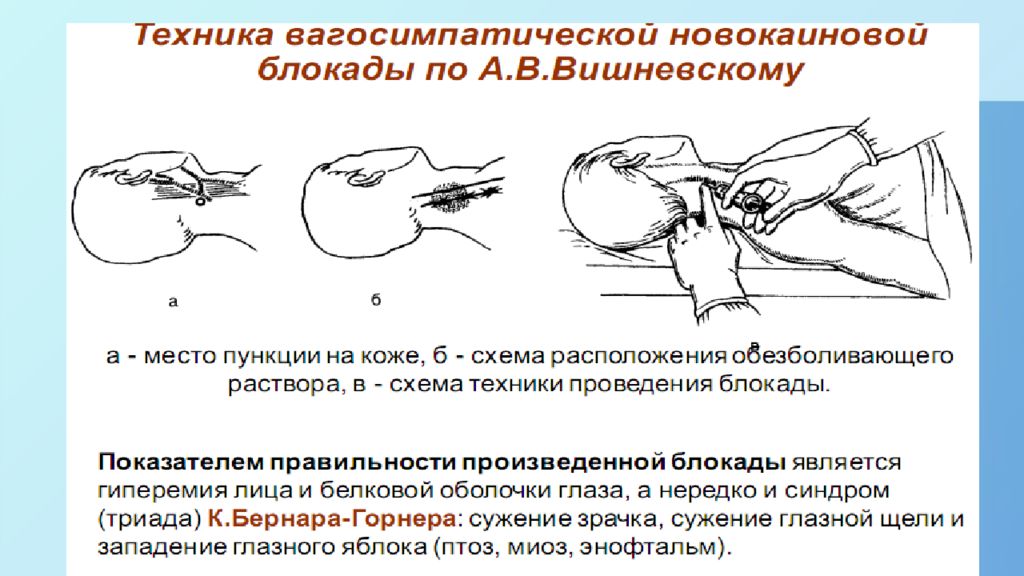 Оперативная хирургия головы и шеи презентация