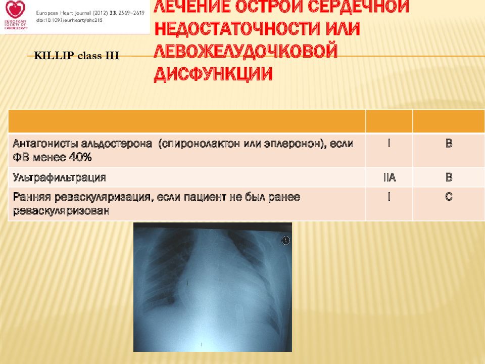 Левожелудочковая недостаточность презентация