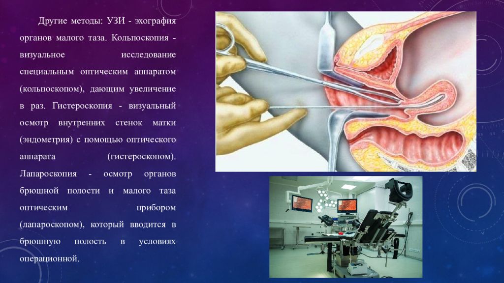 Презентация на тему узи