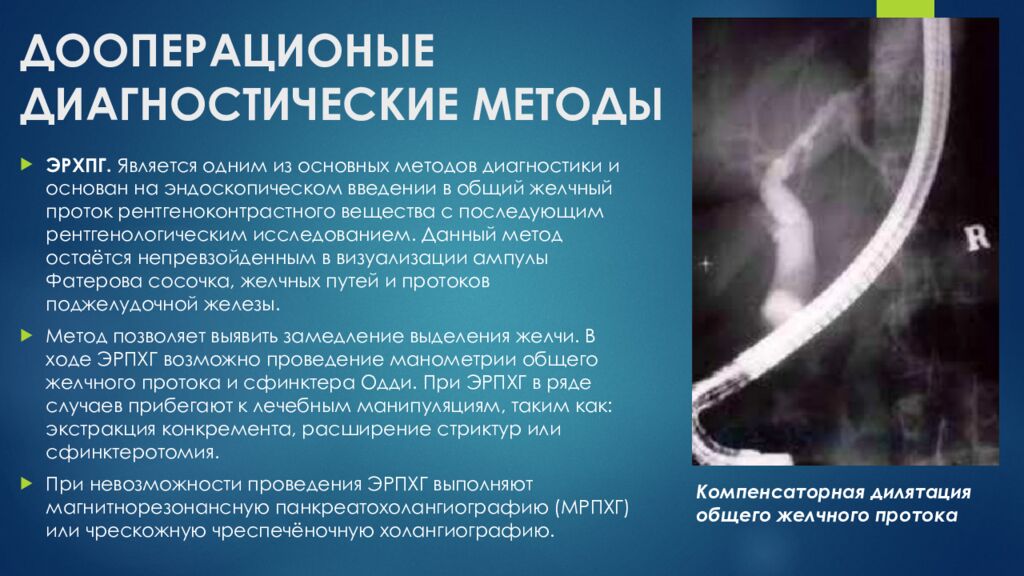 ДООПЕРАЦИОНЫЕ ДИАГНОСТИЧЕСКИЕ МЕТОДЫ