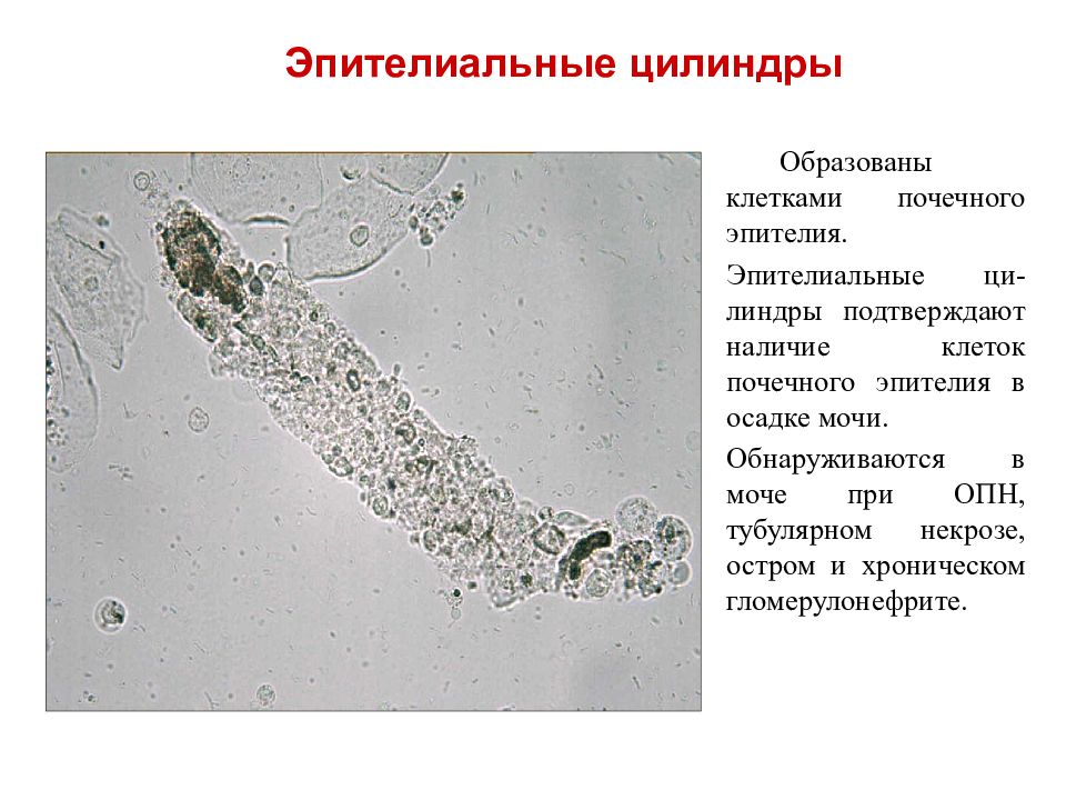 Микроскопия осадка мочи фото с описанием