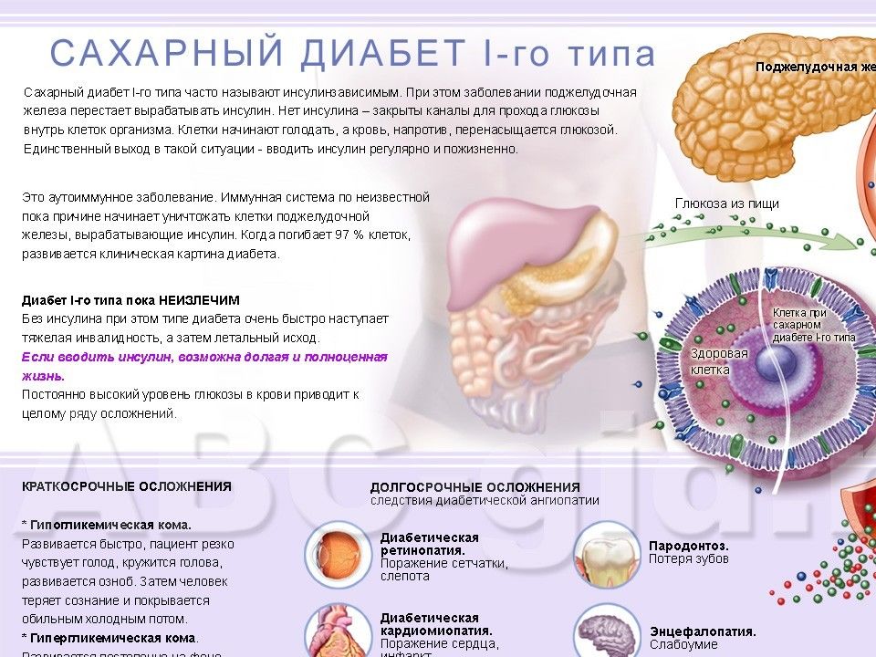 Сахарный диабет 1 и 2 типа презентация