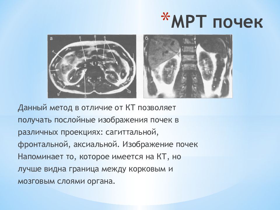 Получить послойное изображение органа позволяет