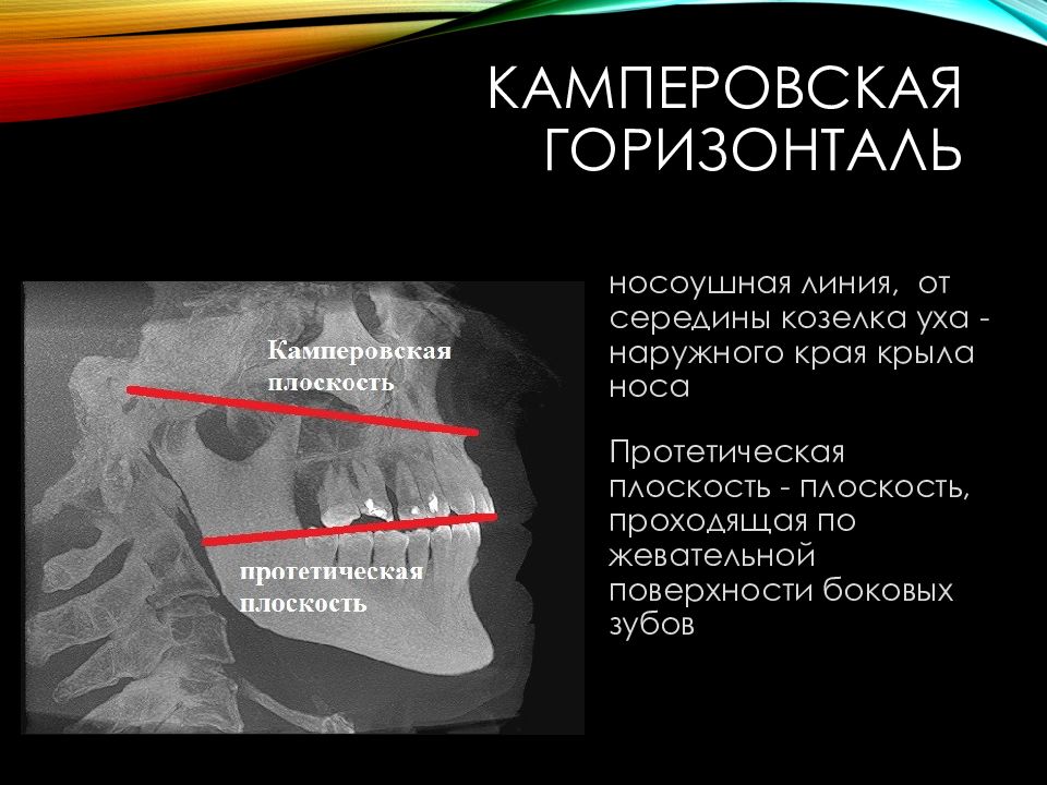 Лицевая дуга презентация